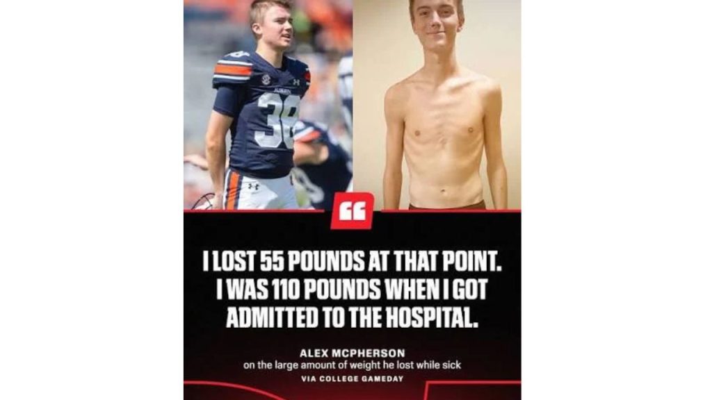 Alex McPherson Illness: Auburn Kicker Overcomes Severe Ulcerative Colitis
